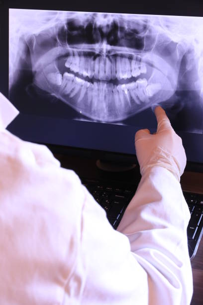 Best Emergency Treatment for Toothache in Farmington, PA